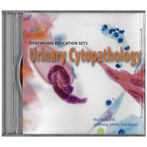 ASC CD ROMS | Urinary Cytopathology